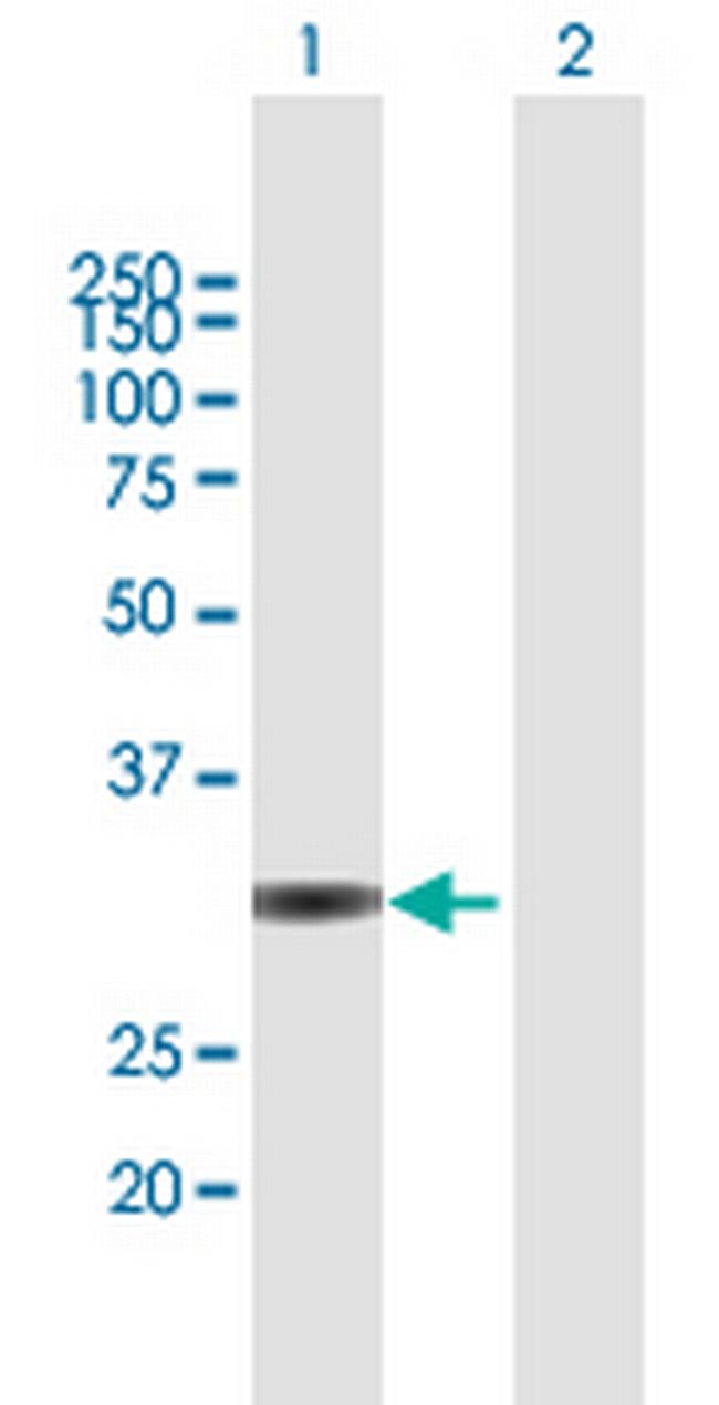 UNKL Antibody in Western Blot (WB)