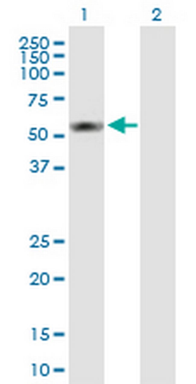 S100PBP Antibody in Western Blot (WB)