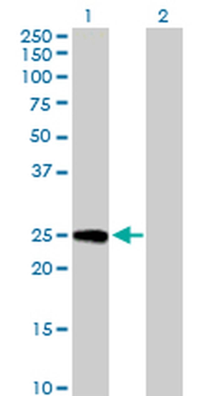 FLJ13912 Antibody in Western Blot (WB)