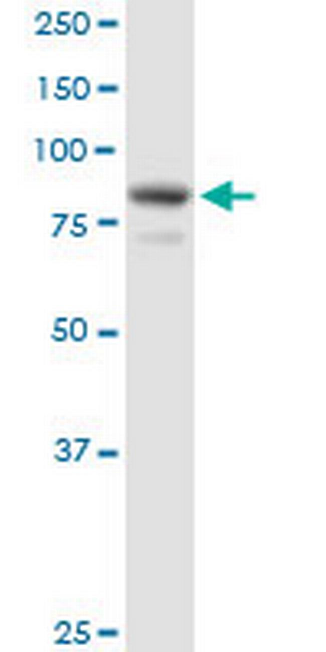 EPS8L2 Antibody in Western Blot (WB)