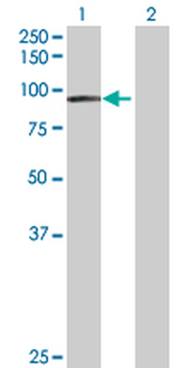 EPS8L2 Antibody in Western Blot (WB)