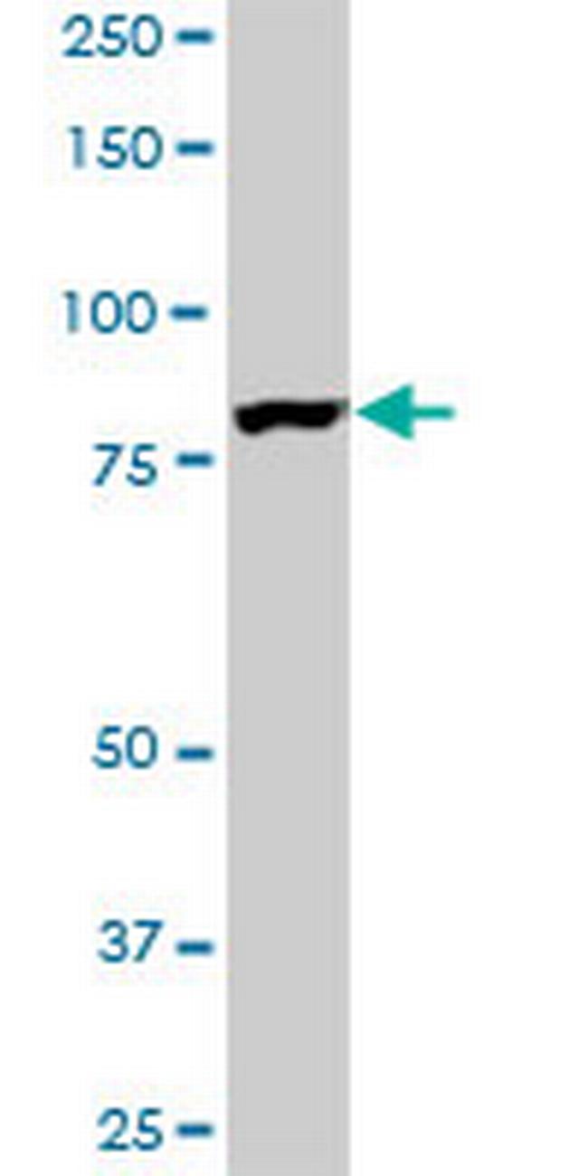 EPS8L2 Antibody in Western Blot (WB)