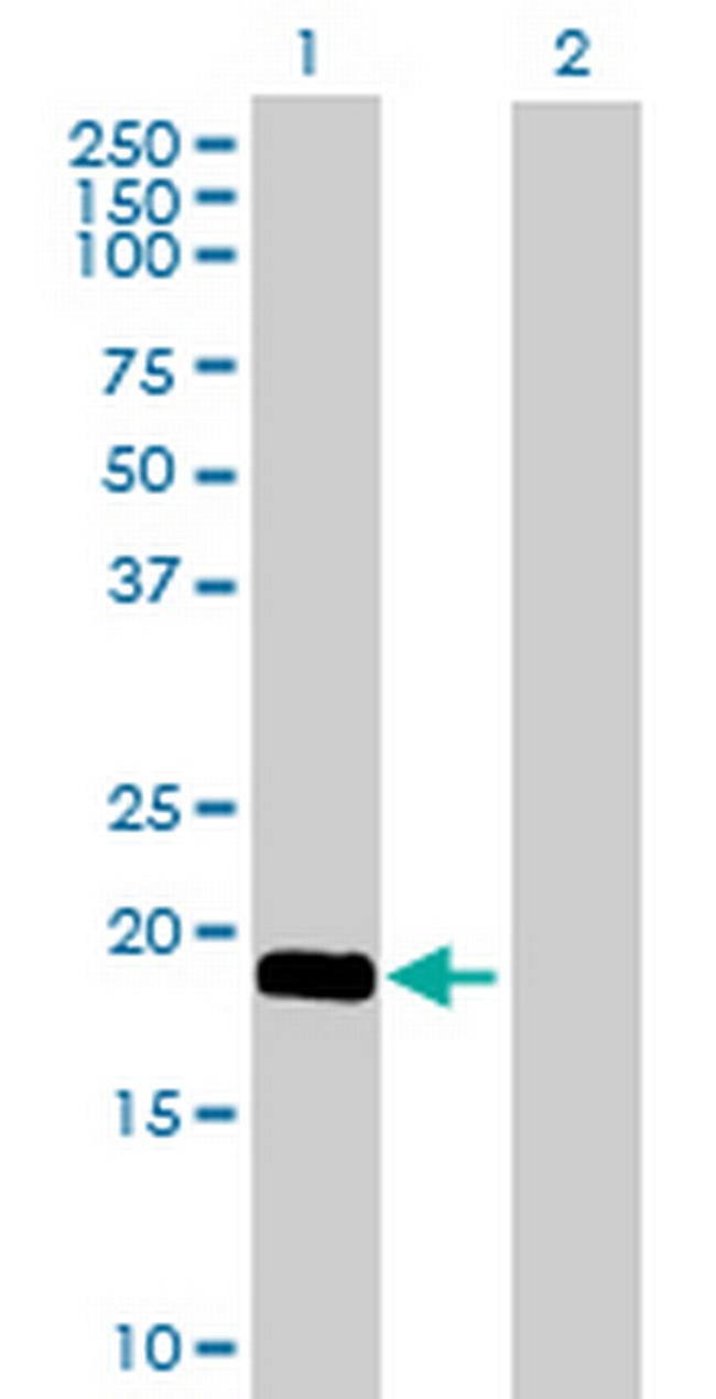 RABL5 Antibody in Western Blot (WB)
