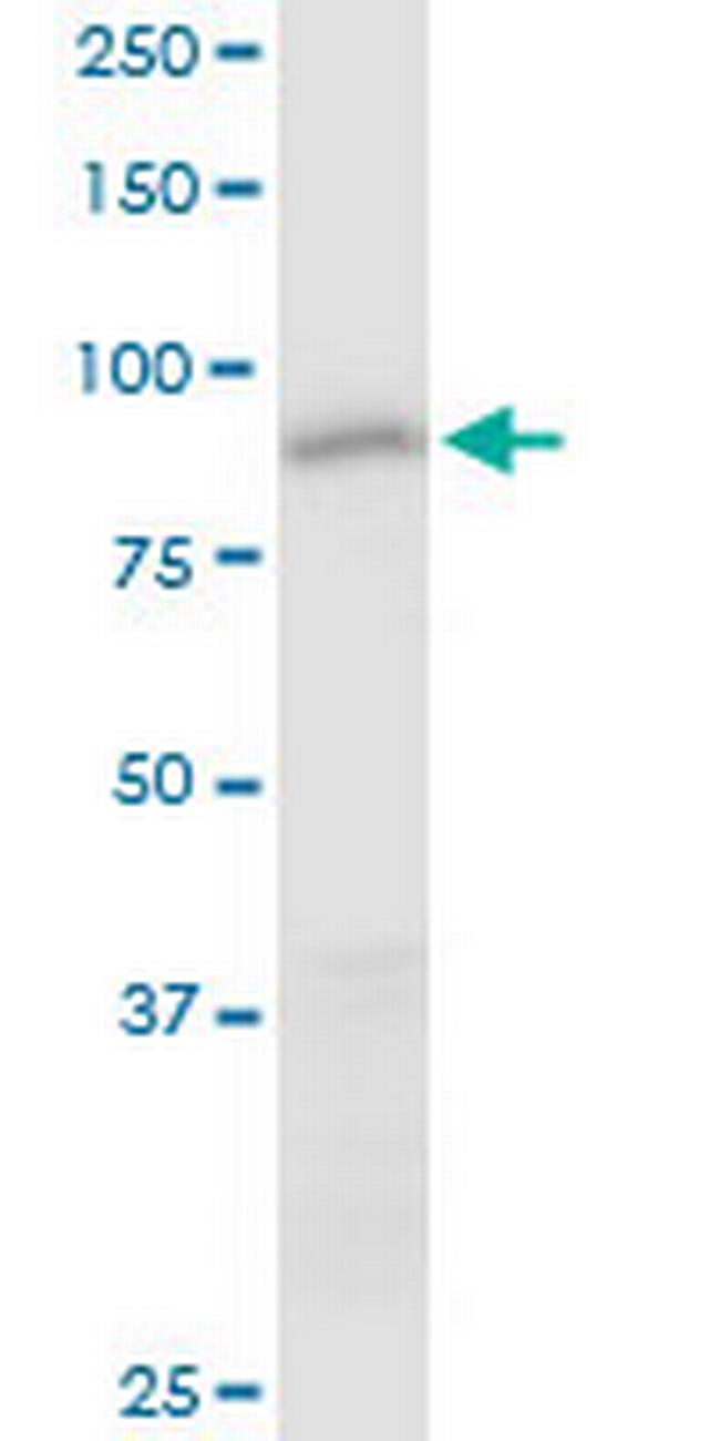 CCDC21 Antibody in Western Blot (WB)