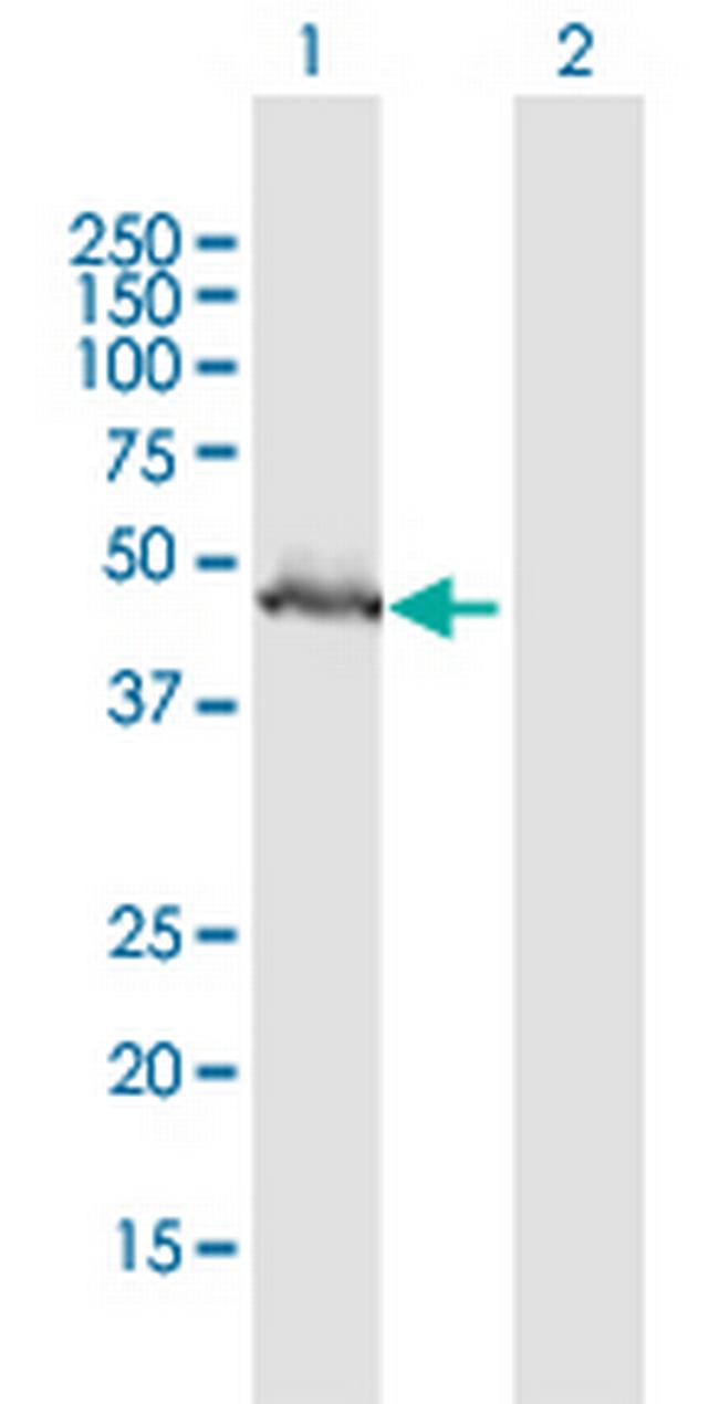 DEPDC6 Antibody in Western Blot (WB)