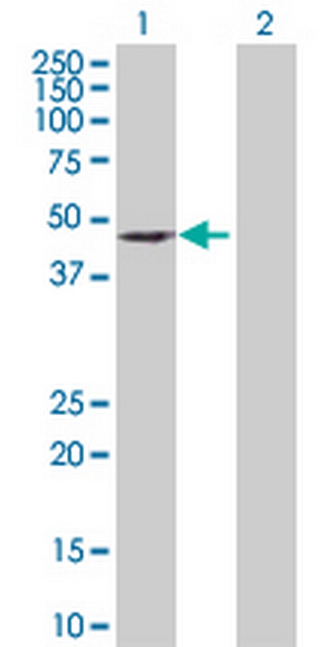DEPDC6 Antibody in Western Blot (WB)