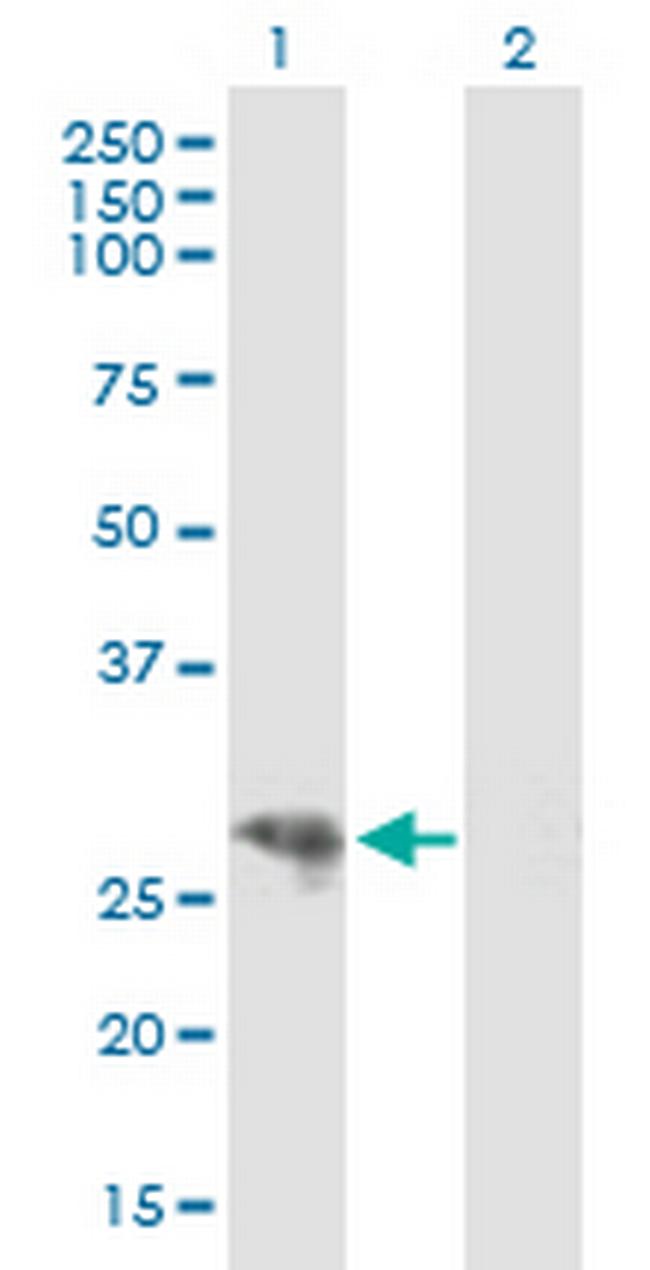 CYP3A43 Antibody in Western Blot (WB)