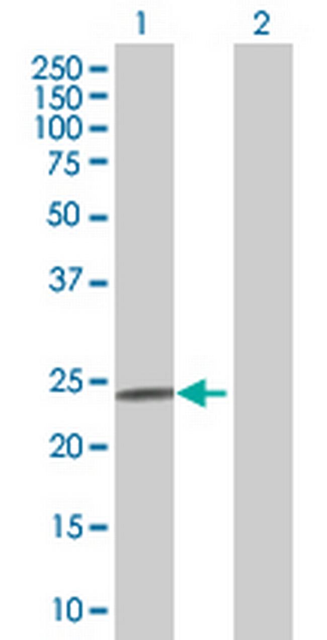 FNDC4 Antibody in Western Blot (WB)