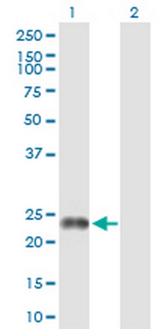FNDC4 Antibody in Western Blot (WB)