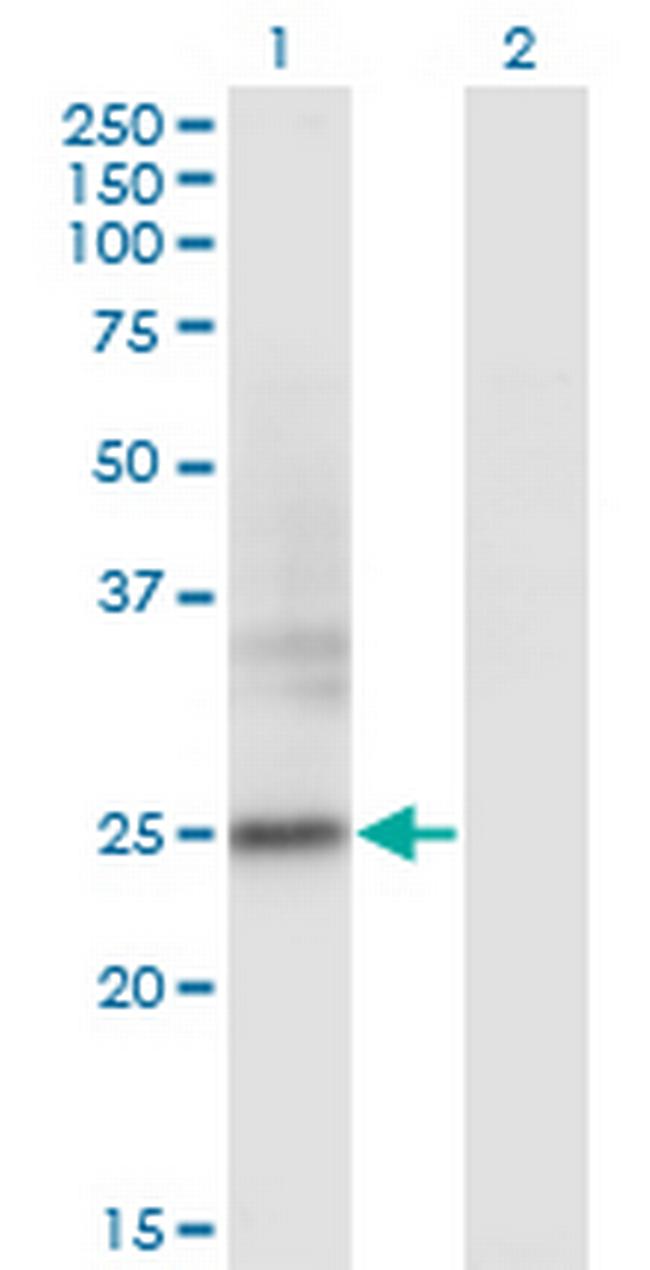 FNDC4 Antibody in Western Blot (WB)