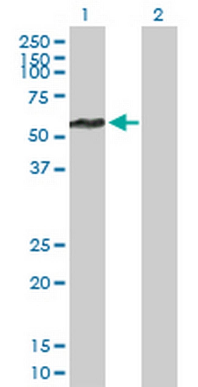 FBXL17 Antibody in Western Blot (WB)