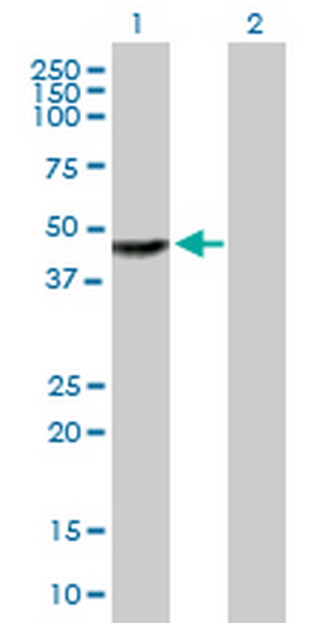 TTC23 Antibody in Western Blot (WB)