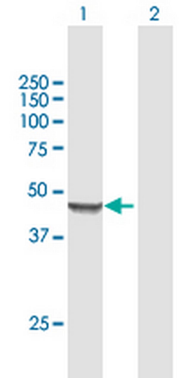 MRPS9 Antibody in Western Blot (WB)