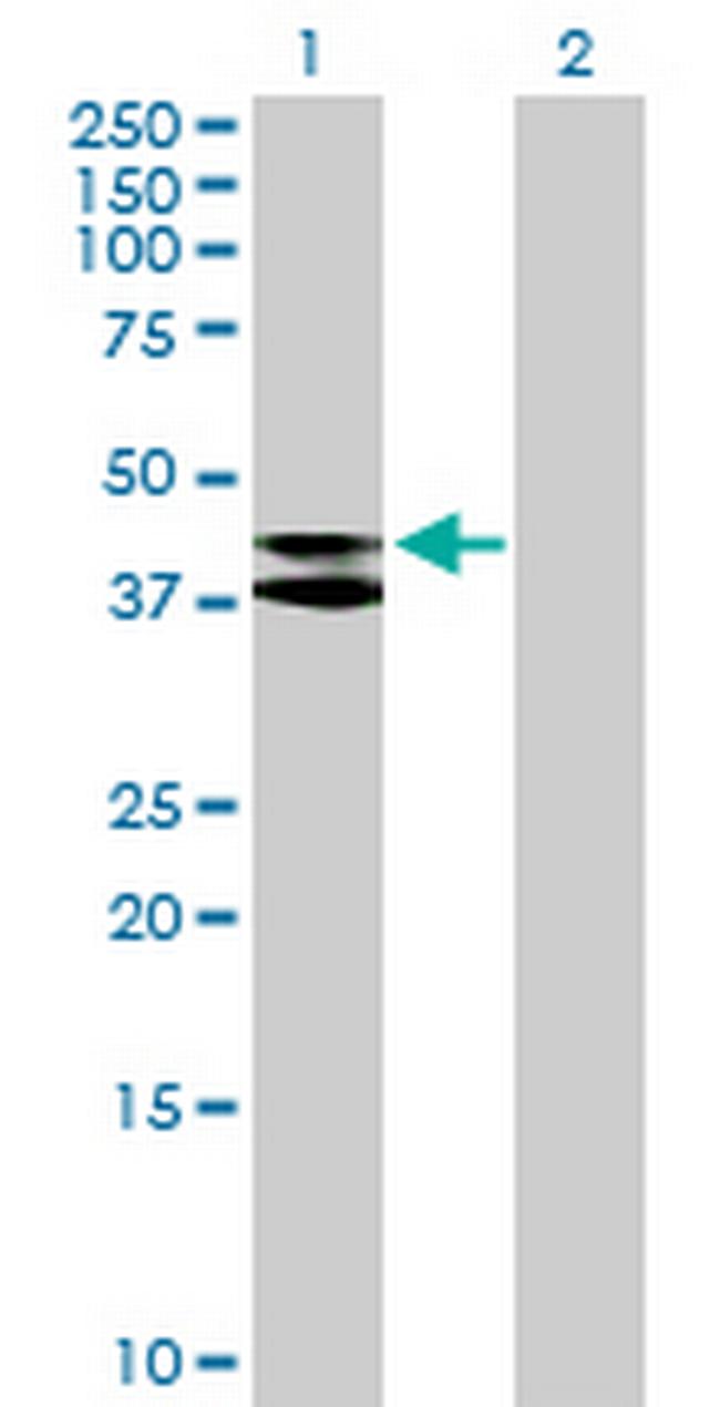 MRPS9 Antibody in Western Blot (WB)
