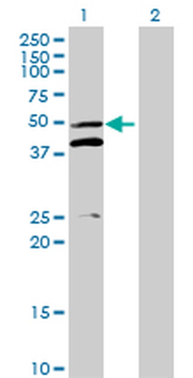 MRPS5 Antibody in Western Blot (WB)