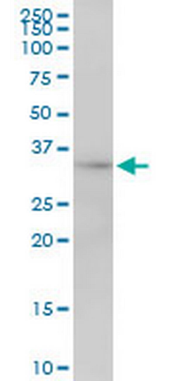 MRPL1 Antibody in Western Blot (WB)