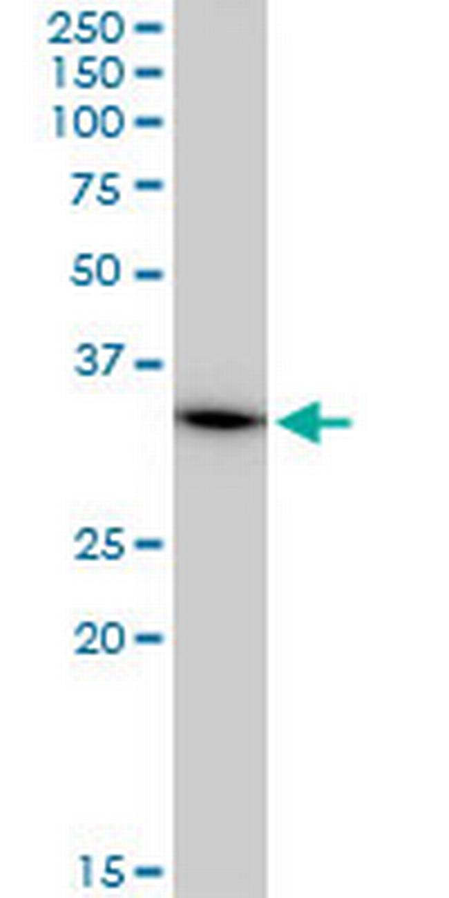 MRPL1 Antibody in Western Blot (WB)