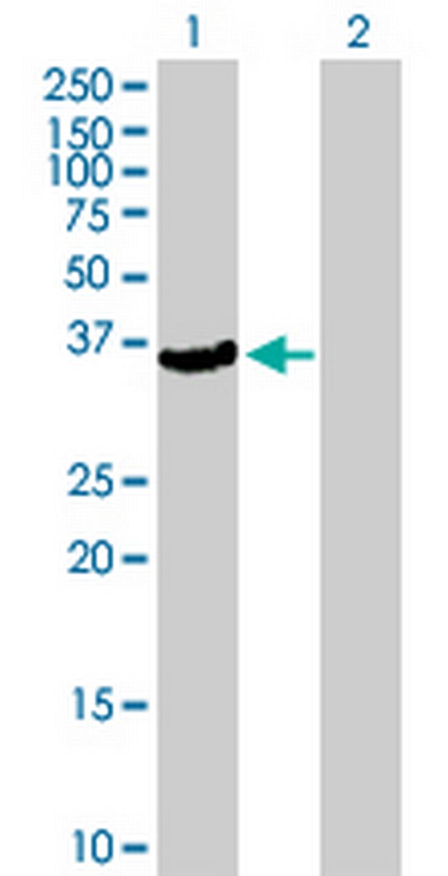 PFTK2 Antibody in Western Blot (WB)