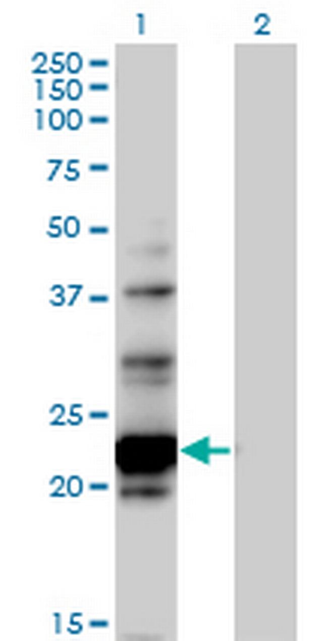NOL6 Antibody in Western Blot (WB)