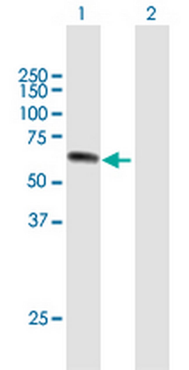 UPF3A Antibody in Western Blot (WB)