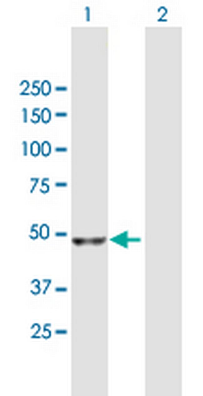 NADK Antibody in Western Blot (WB)