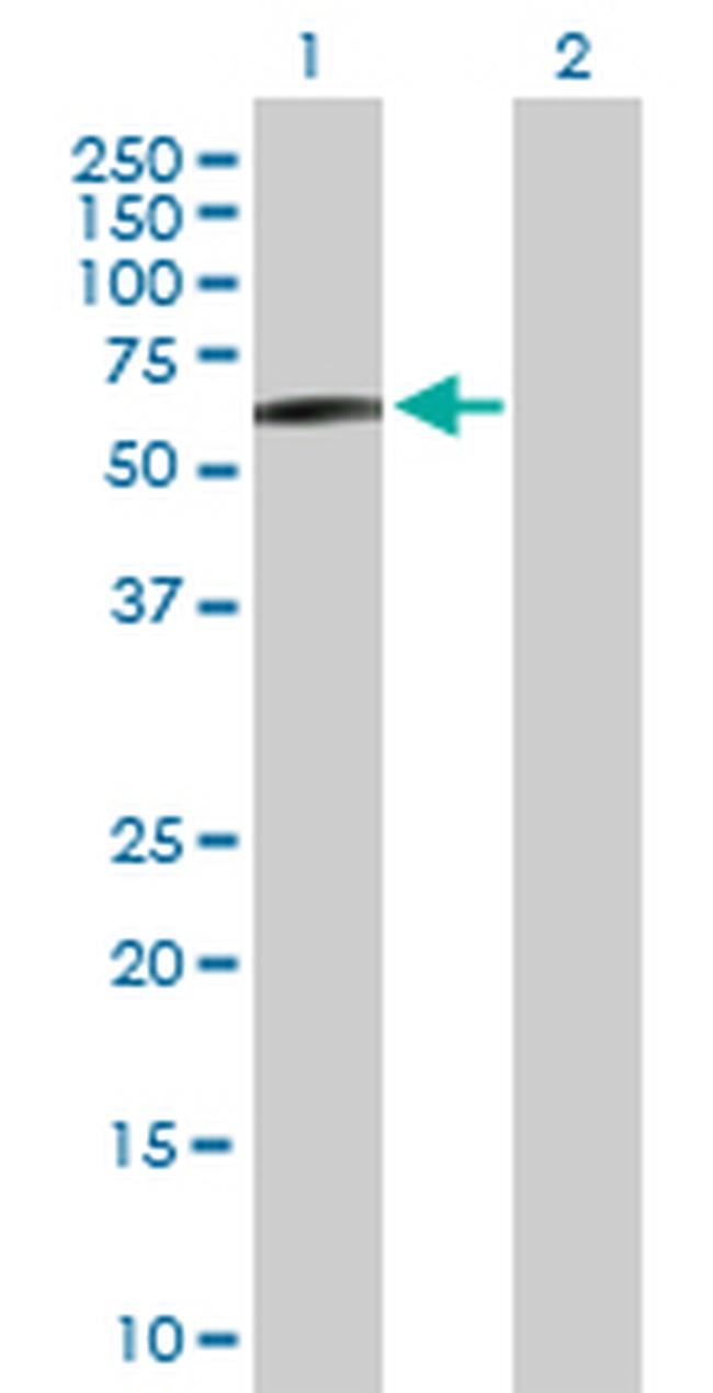 STK33 Antibody in Western Blot (WB)