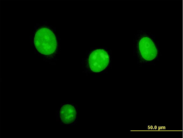 STK33 Antibody in Immunocytochemistry (ICC/IF)