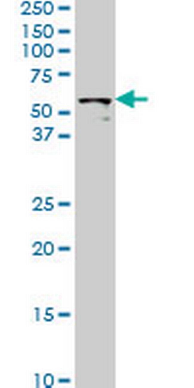 STK33 Antibody in Western Blot (WB)