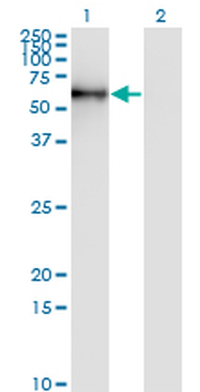 STK33 Antibody in Western Blot (WB)