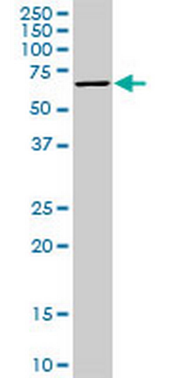 STK33 Antibody in Western Blot (WB)