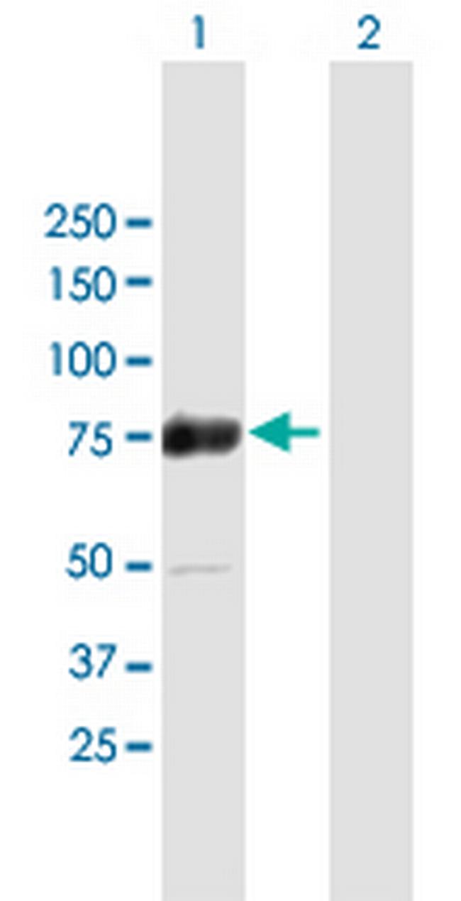 ZSCAN18 Antibody in Western Blot (WB)