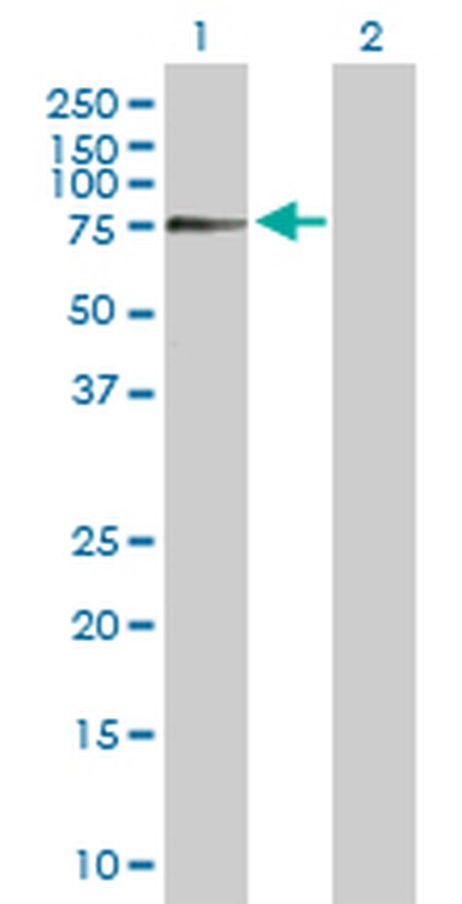 ZSCAN18 Antibody in Western Blot (WB)
