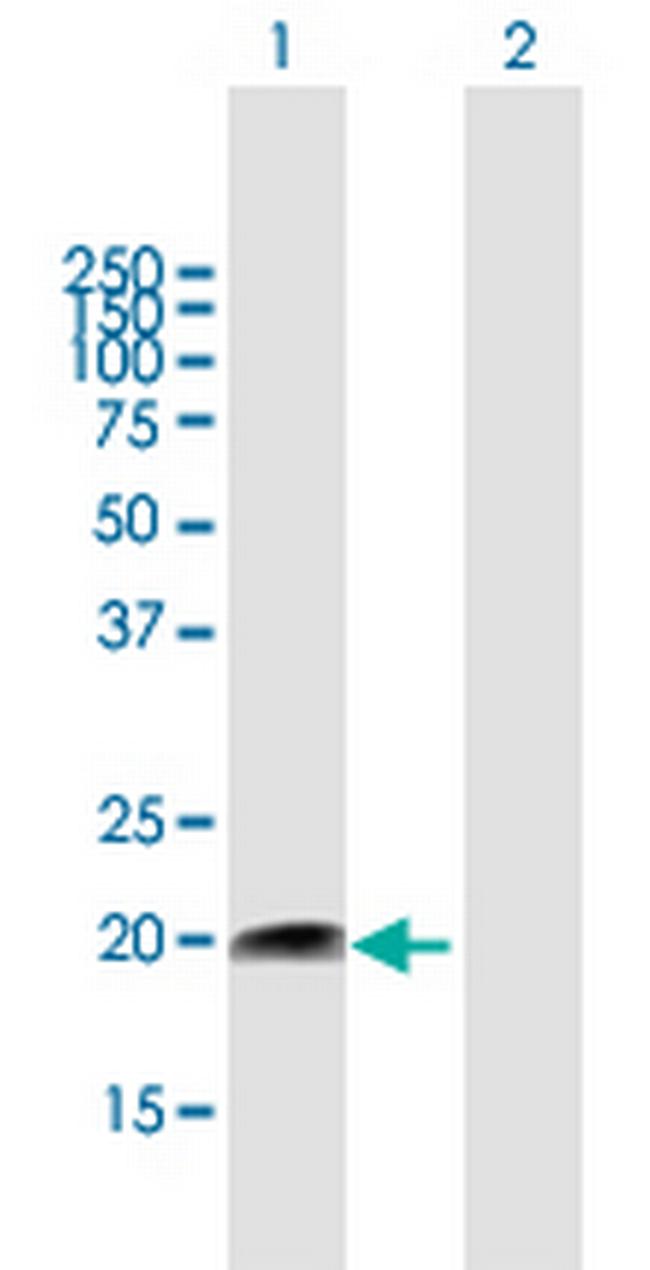 FUNDC2 Antibody in Western Blot (WB)