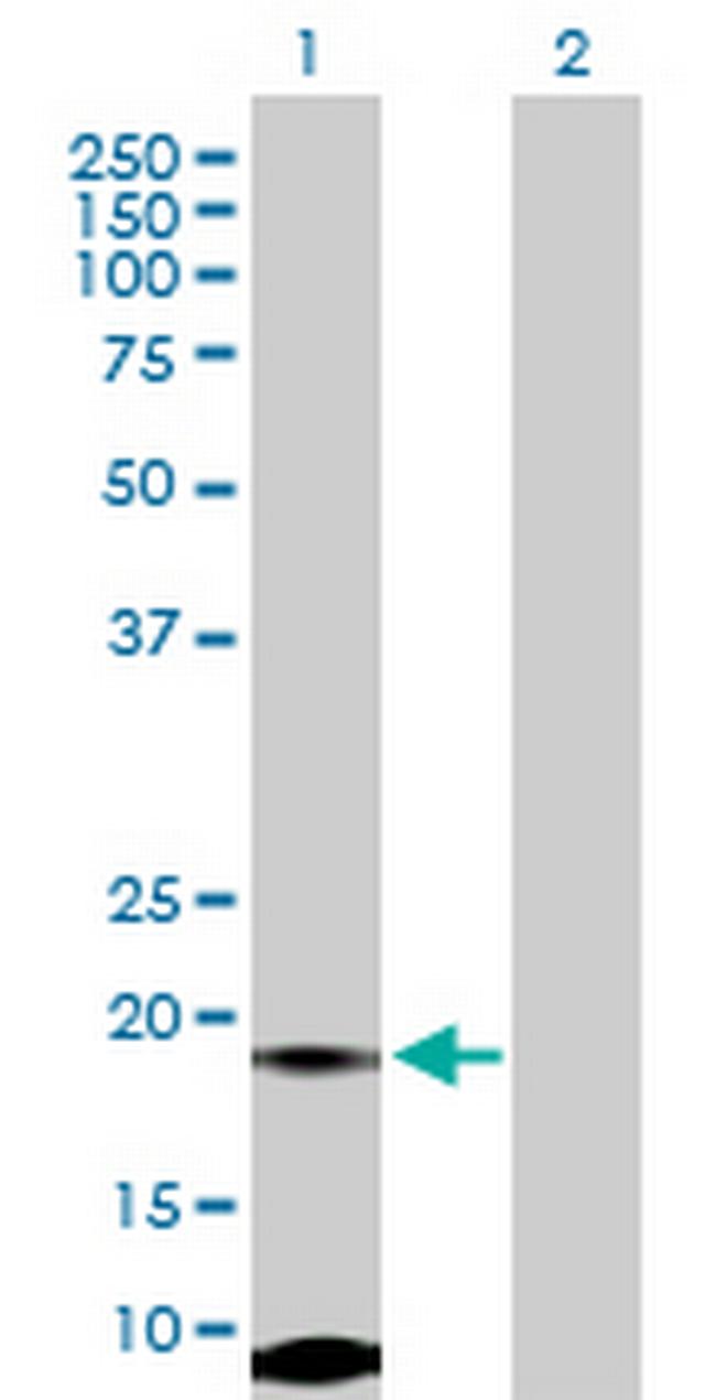 FUNDC2 Antibody in Western Blot (WB)