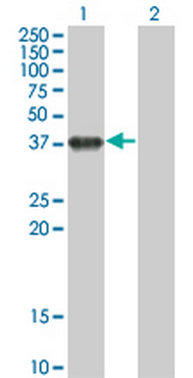 BOLL Antibody in Western Blot (WB)