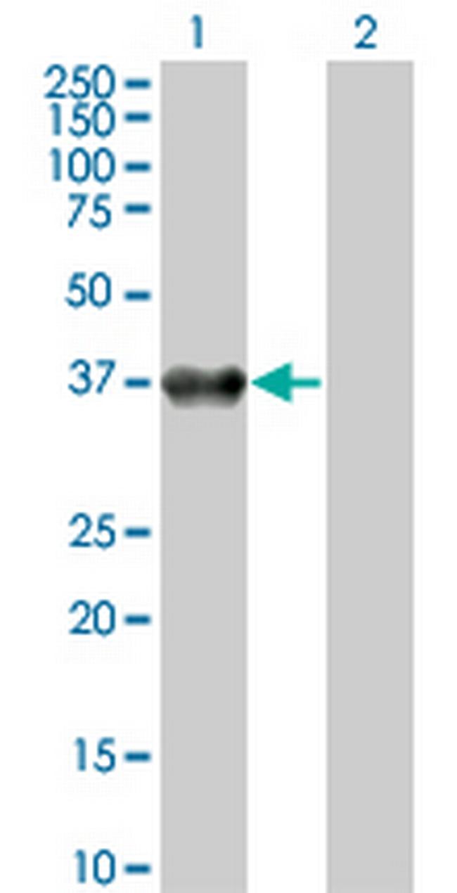 BOLL Antibody in Western Blot (WB)
