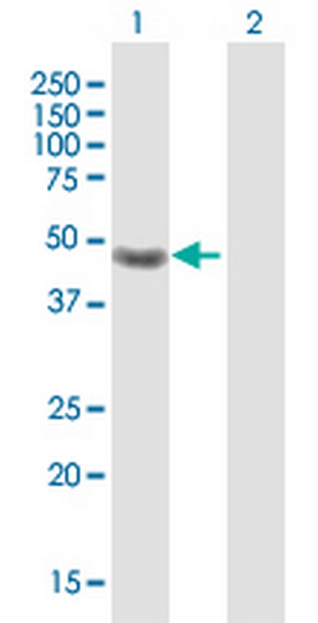 CRELD1 Antibody in Western Blot (WB)