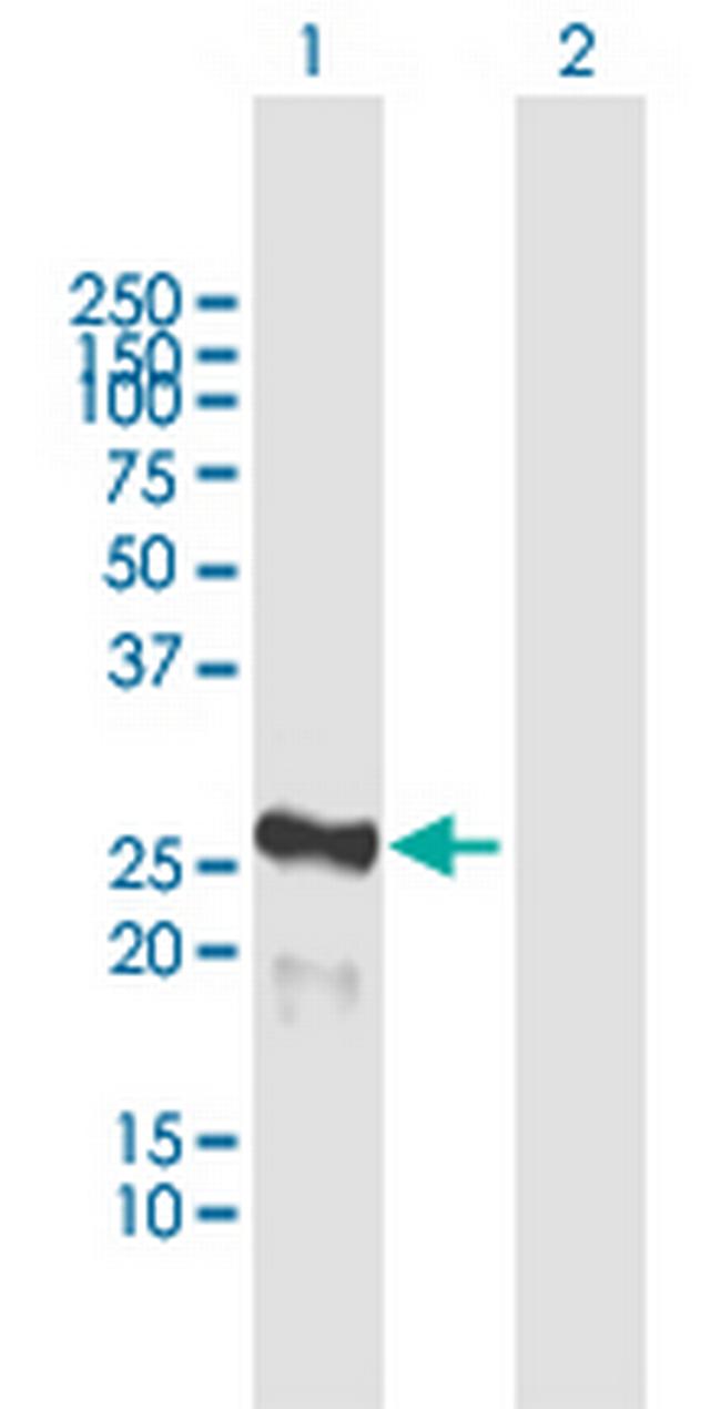 MIS12 Antibody in Western Blot (WB)