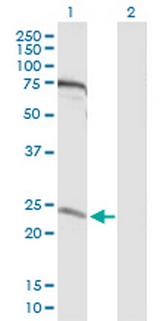 MIS12 Antibody in Western Blot (WB)