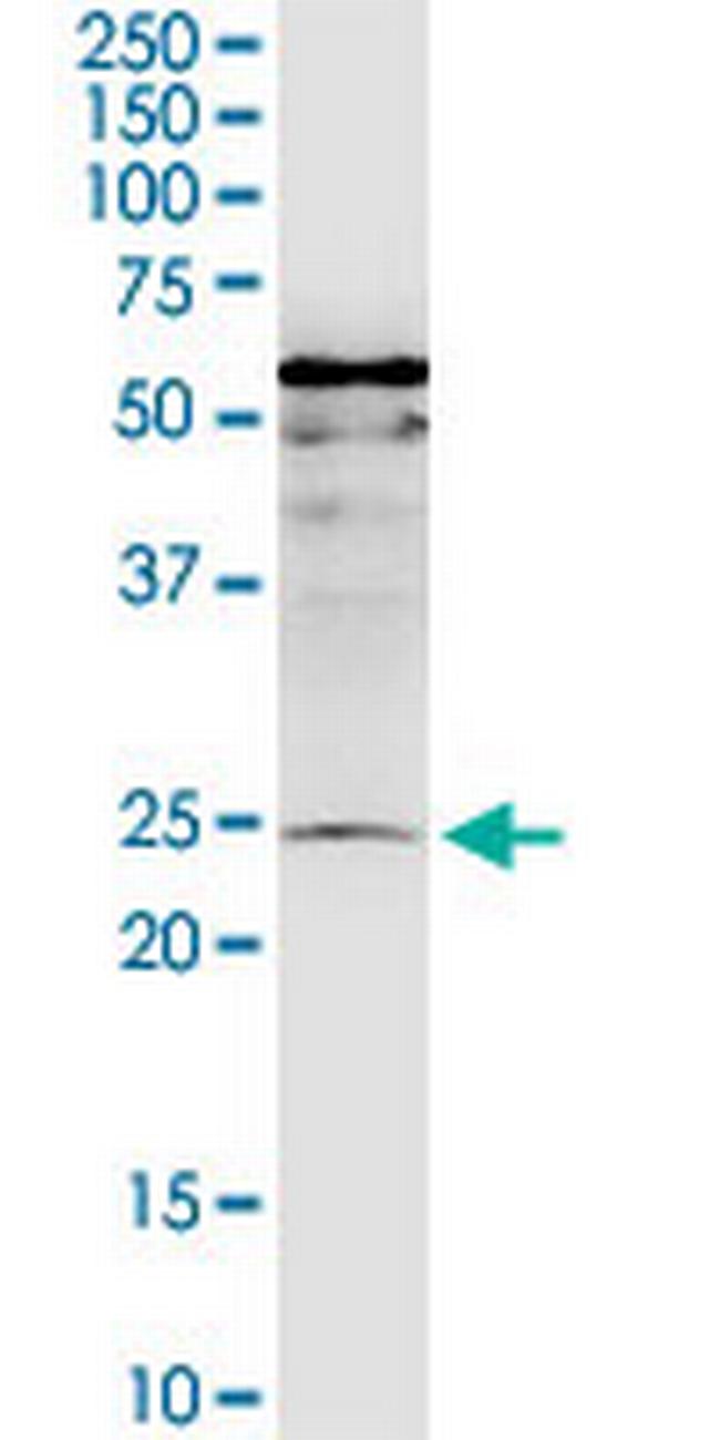 MIS12 Antibody in Western Blot (WB)