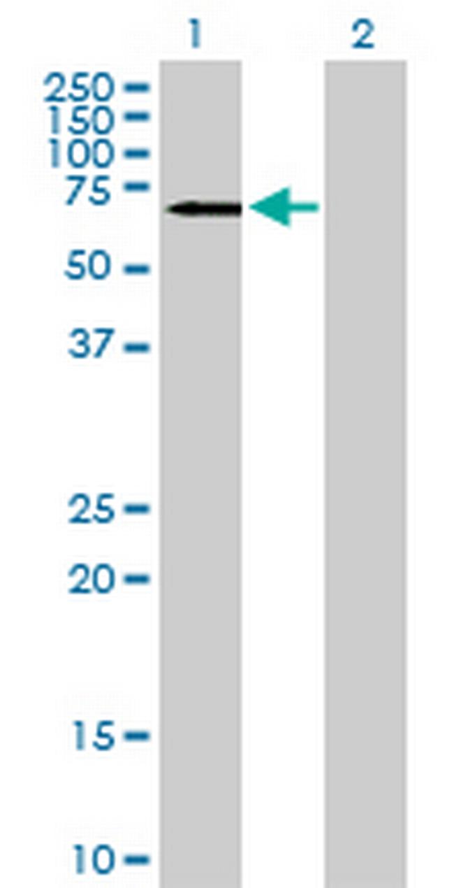 CAMKV Antibody in Western Blot (WB)