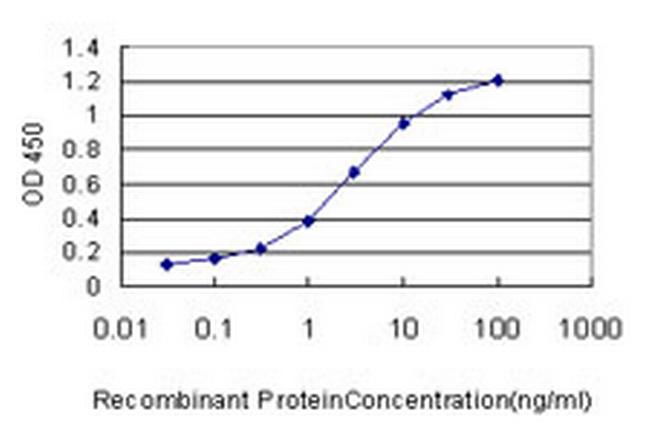 CAMKV Antibody in ELISA (ELISA)