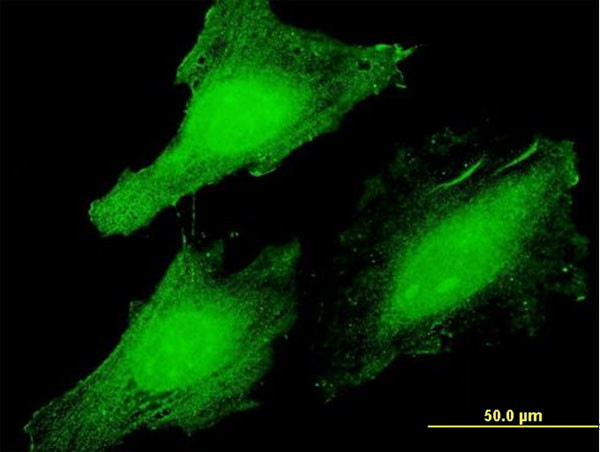 CLUHP3 Antibody in Immunocytochemistry (ICC/IF)