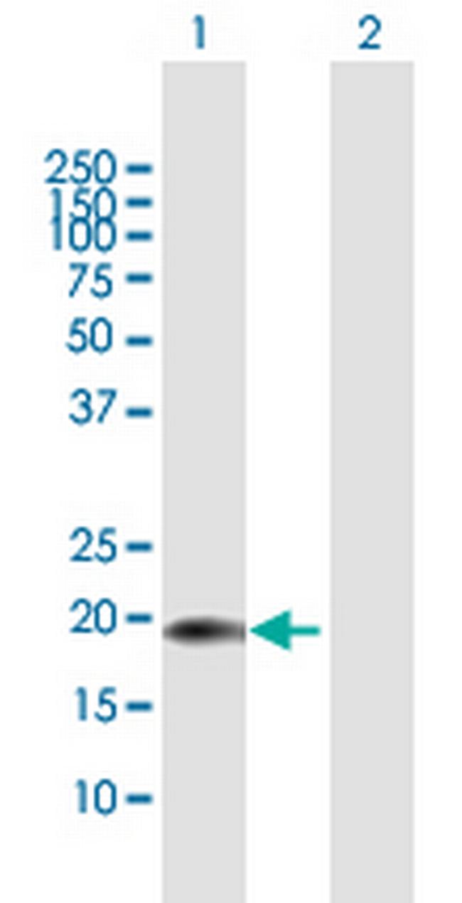 CENPM Antibody in Western Blot (WB)