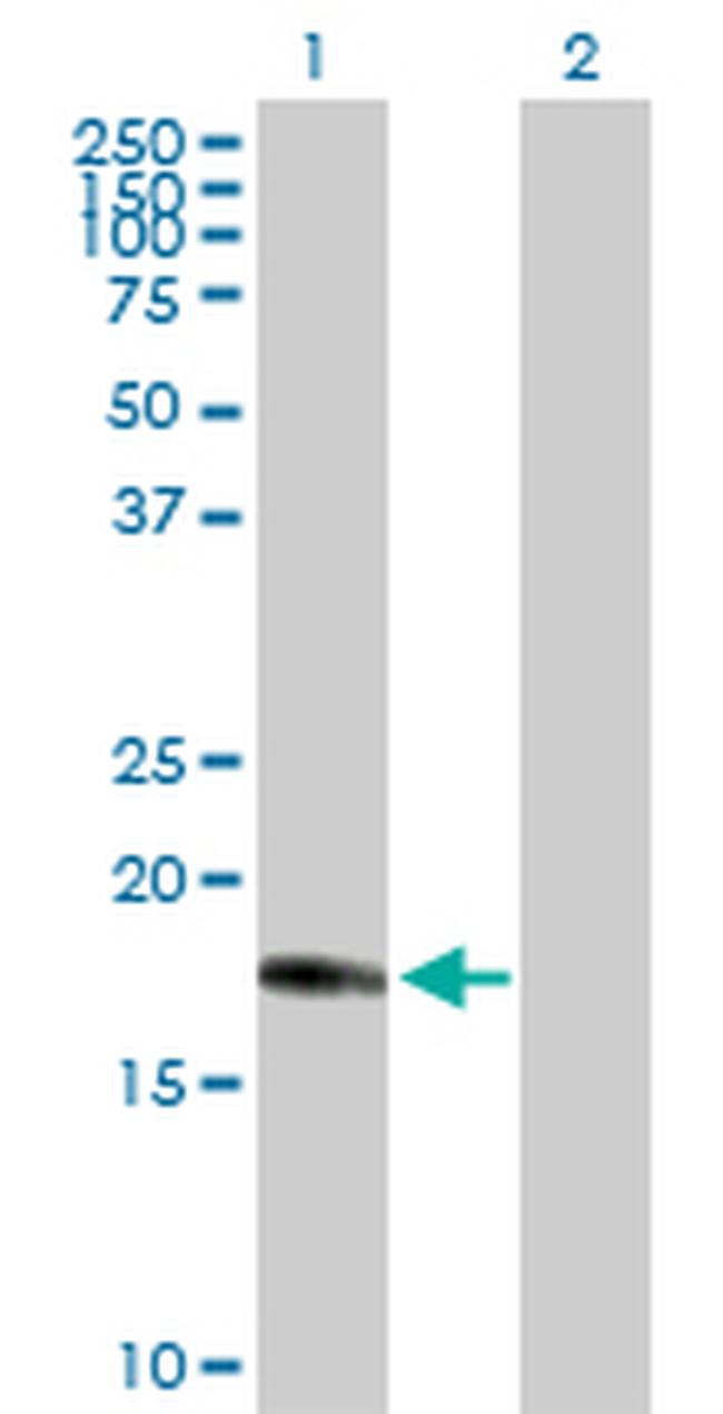 CENPM Antibody in Western Blot (WB)