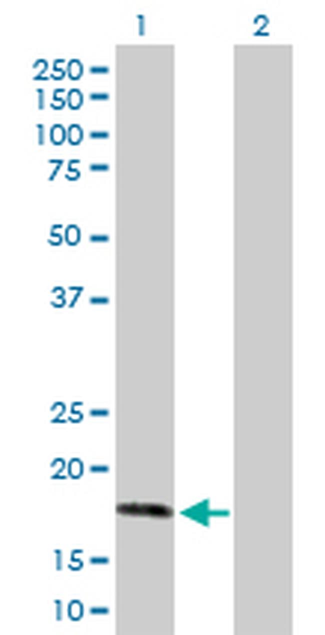 AHNAK Antibody in Western Blot (WB)