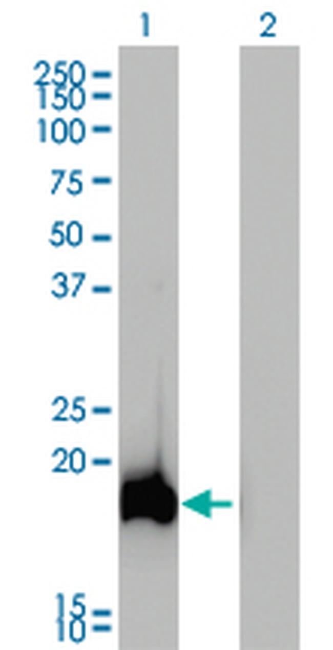 AHNAK Antibody in Western Blot (WB)