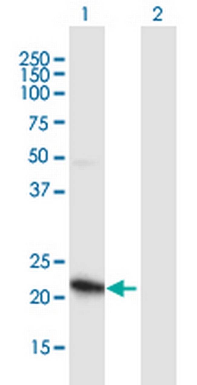 ZNF655 Antibody in Western Blot (WB)