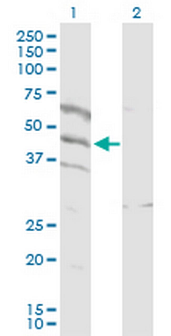 SPATA5L1 Antibody in Western Blot (WB)