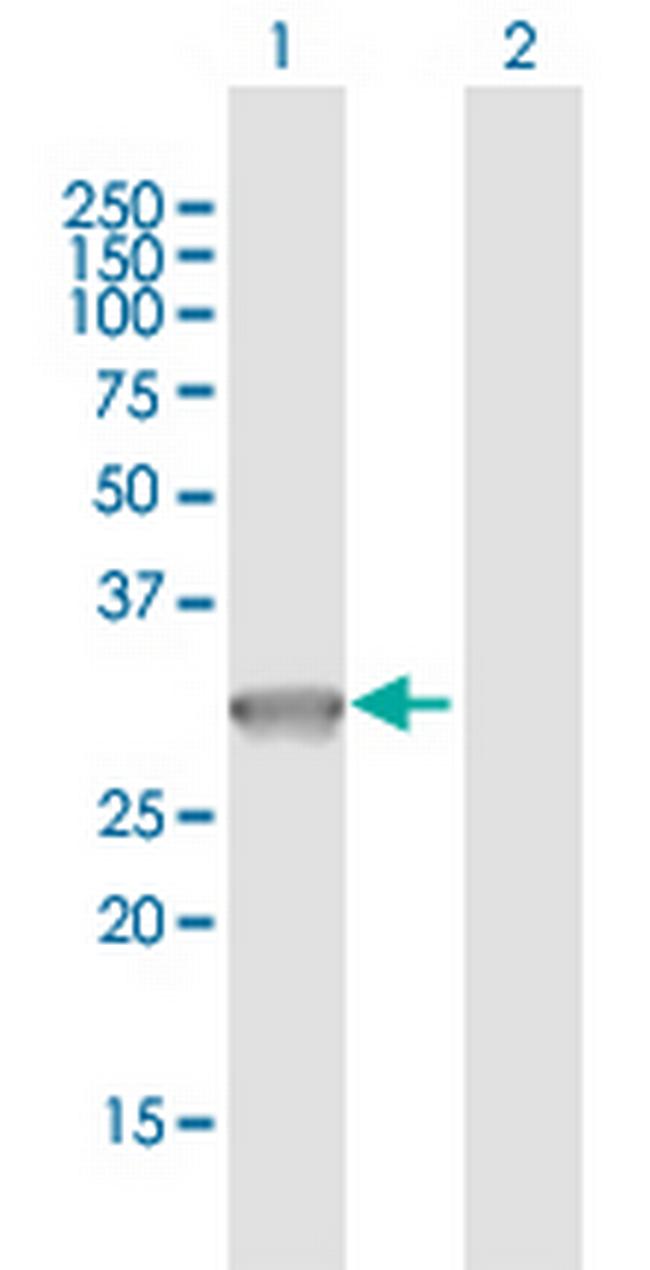 PVRIG Antibody in Western Blot (WB)